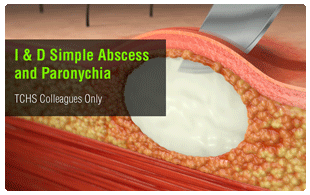 I & D Simple Abscess
and Paronychia - TCHS Colleagues Only