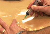 Injection Trigger Point Model